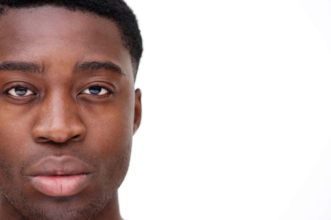 Procedures_Men_Eyelid-Rejuvenation